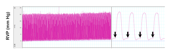 figure-results-5 Right ventricular pressure (RVP) waveform chart; cardiac cycle analysis, pressure changes.