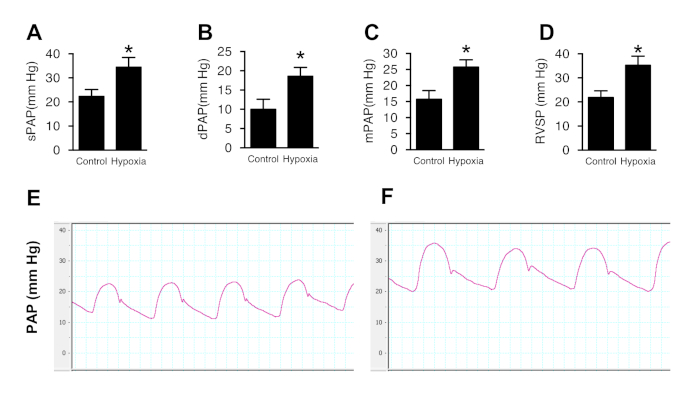 figure-results-6 Pulmonary pressure changes; bar graphs, pressure waveforms; hypoxia effect; cardiovascular research.