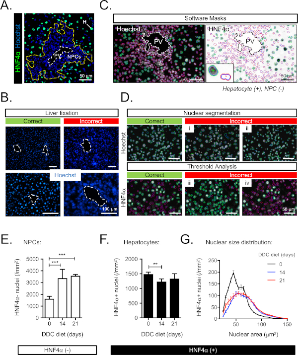 Liver cell segmentation using Hoechst and HNF4α; analysis charts of NPC and hepatocyte nuclei.