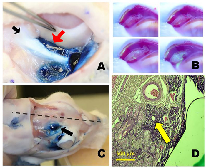 Colorazione del tessuto dentale e studio istologico; immagini al microscopio, procedura chirurgica, micrografie.