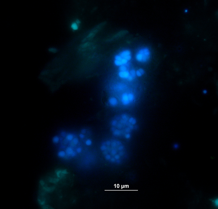 Fluorescence microscopy image, DNA stained cells; cellular imaging, biological research, 10 µm scale.
