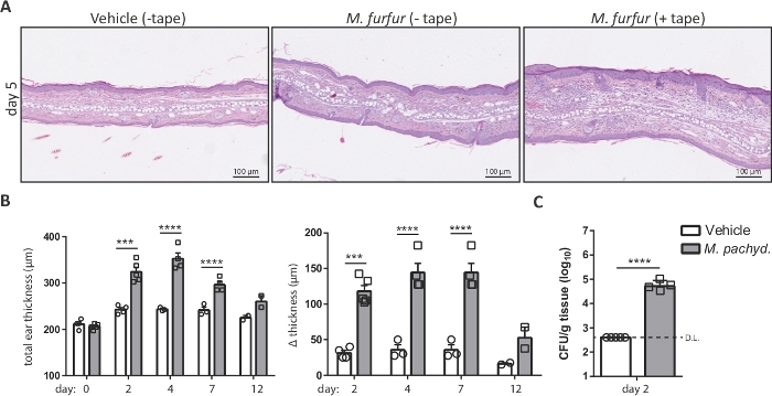 Histological diagram of skin layers with graphs; ear thickness data analysis in study.