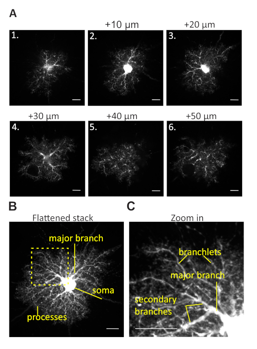 Neuron structure microscopy; confocal imaging; digital stack; branches visualized; cellular analysis.