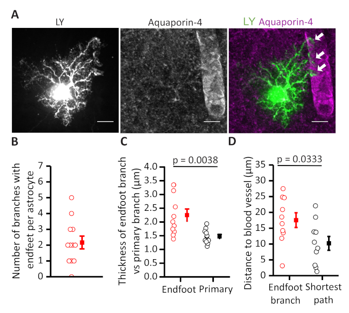 Astrocyte analysis, LY and Aquaporin-4 imaging, graphs of branch thickness and blood vessel distance.