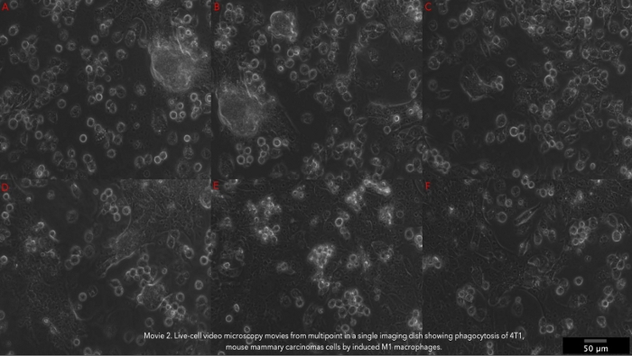 Time-Lapse 2D Imaging der phagozytischen Aktivität in M1 Macrophage-4T1 ...