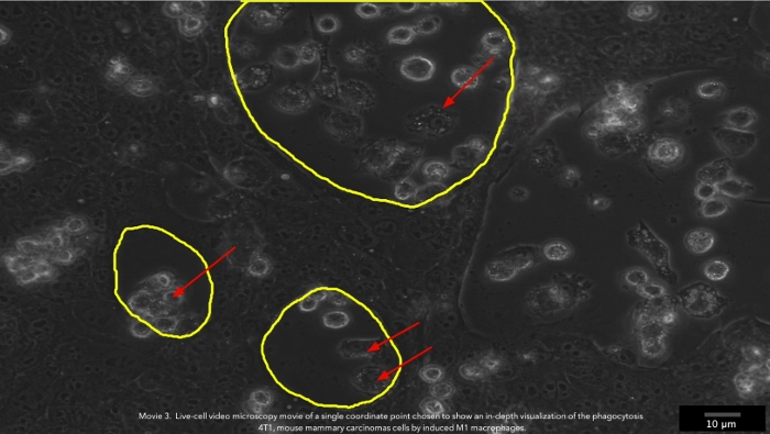Video: Time-Lapse 2D Imaging of Phagocytic Activity in M1 Macrophage ...