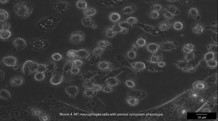 Video: Time-Lapse 2D Imaging of Phagocytic Activity in M1 Macrophage ...