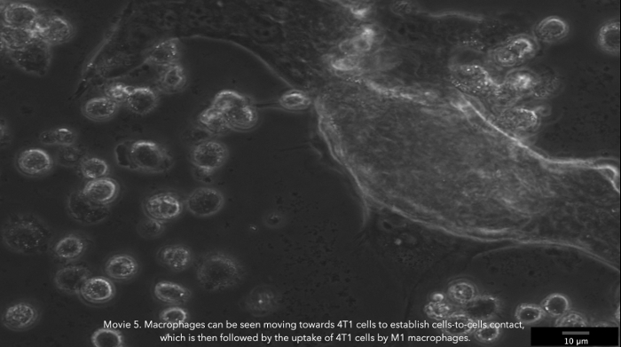 Video: Time-Lapse 2D Imaging of Phagocytic Activity in M1 Macrophage ...