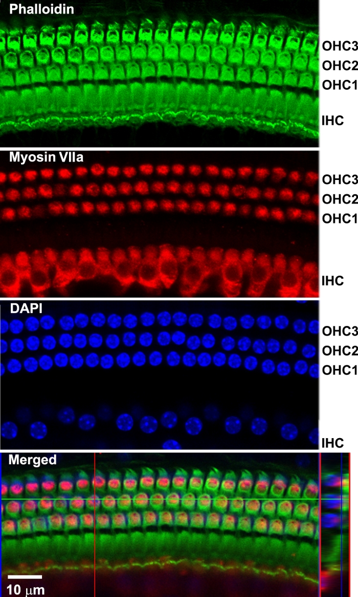 figure-results-4 Immunofluorescence microscopy of cochlear hair cells; phalloidin, myosin VIIa, DAPI staining, merged.