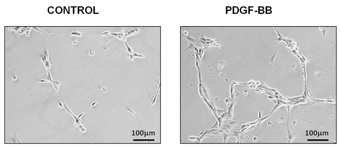 Cell growth comparison under control vs PDGF-BB conditions; microscopy image showing structure changes.