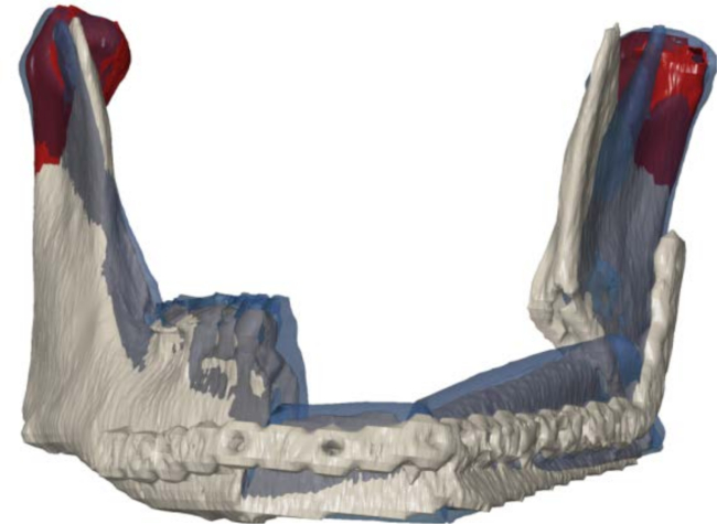 figure-results-3