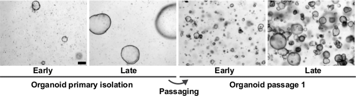Organoid culture stages; microscopy image; primary isolation, passaging, developmental phases.