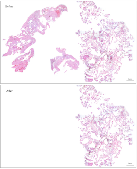 figure-protocol-1 Histology analysis, tissue sample comparison before and after treatment, microscope image.