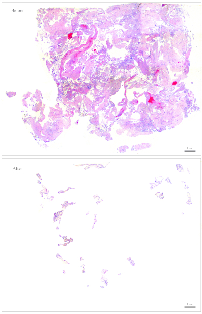 figure-protocol-2 Histological analysis, pre- and post-treatment, tissue staining results, microscopy images.