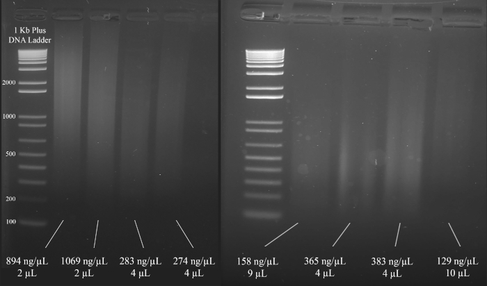 figure-protocol-3 Gel electrophoresis result, DNA band separation, 1 Kb ladder reference, concentration comparison.