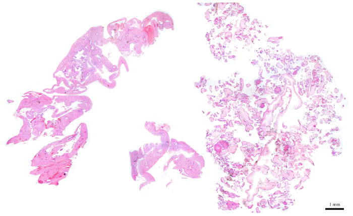 figure-protocol-6 Histological lung tissue slide, microscope image, showcasing cellular structure.