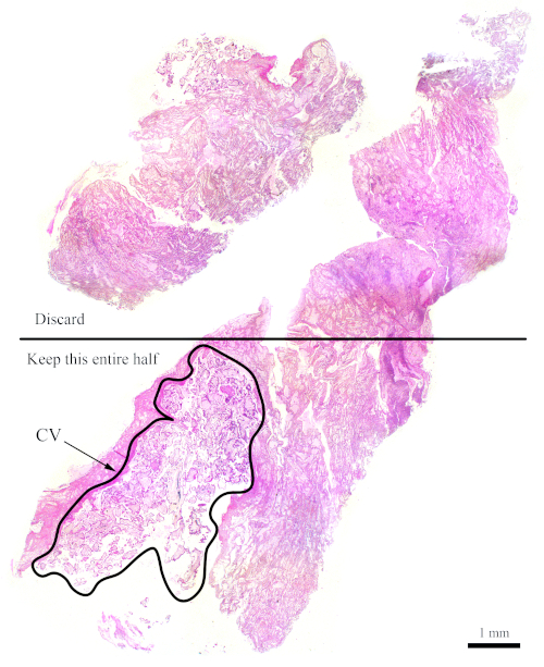 figure-protocol-7 Histological tissue section diagram showing annotated region for cardiology research analysis.