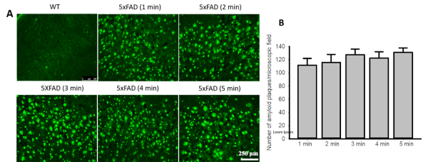 Labeling and Imaging of Amyloid Plaques in Brain Tissue Using the ...