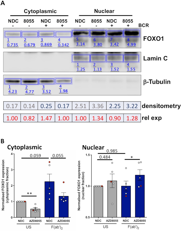 Protein expression analysis, FOXO1 immunoblot, densitometry results; experiment, cytoplasmic vs nuclear.