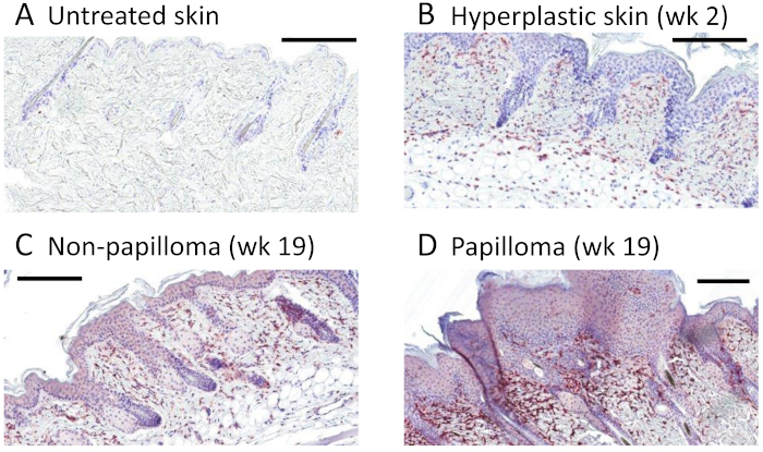 Histological analysis; untreated vs hyperplastic skin, non-papilloma, papilloma stages, microscopy results.