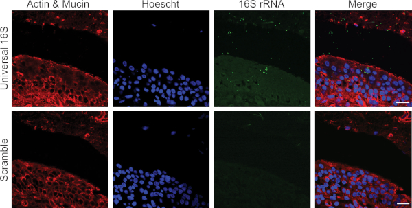 figure-results-1 Fluorescent microscopy of 16S rRNA in tissue; actin, mucin, Hoescht; universal vs. scramble probe.