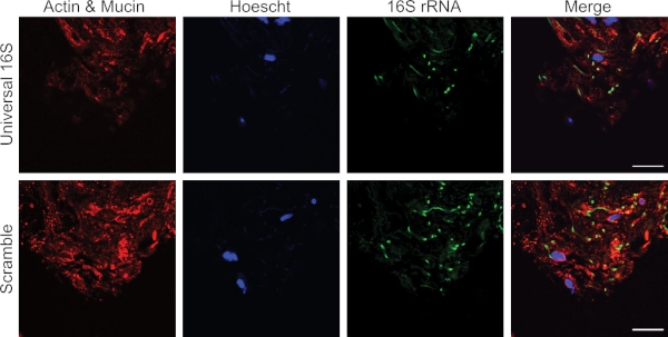 figure-results-2 Fluorescence microscopy showing actin, mucin, Hoechst, 16S rRNA; universal vs. scrambled probe.