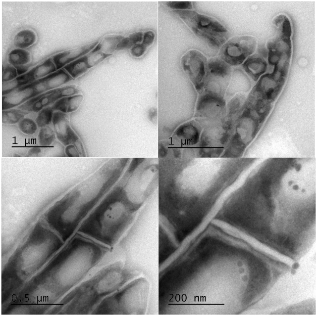 Transmission electron microscopy images of cellular structure at various magnifications, scale bars shown.