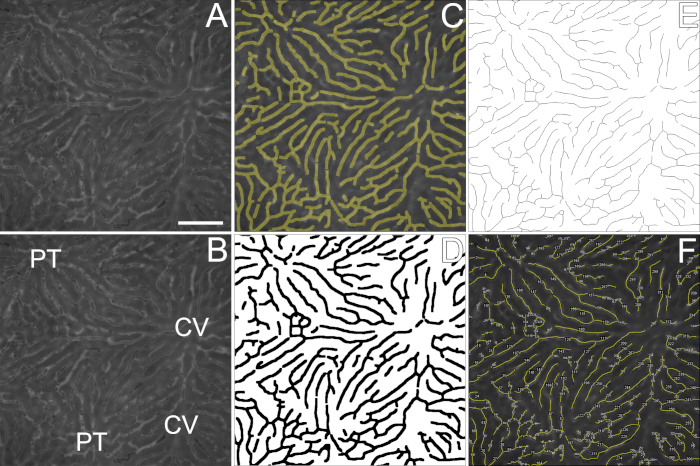 Microscopy image of renal tubule analysis, highlighting structural features; diagram for cellular study.