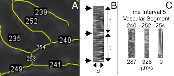 Vascular segmentation and flow speed analysis; diagram showing vessel markings and flow comparison chart.
