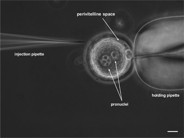 Microinjection process diagram in assisted fertilization with injection and holding pipettes, pronuclei.