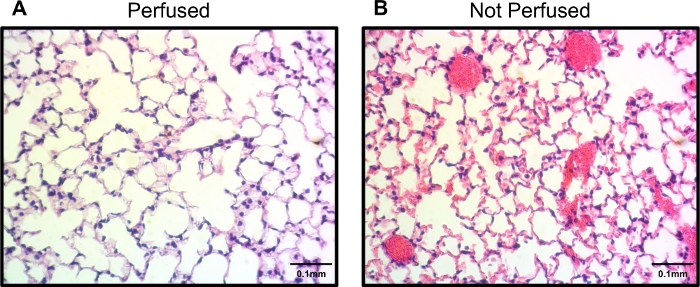 Perfusion comparison; lung tissue histology slides, perfused vs. non-perfused; microscopy result.