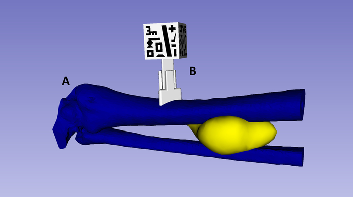 figure-results-3 3D anatomy diagram showing bone-joint simulation with marker setup for motion tracking.