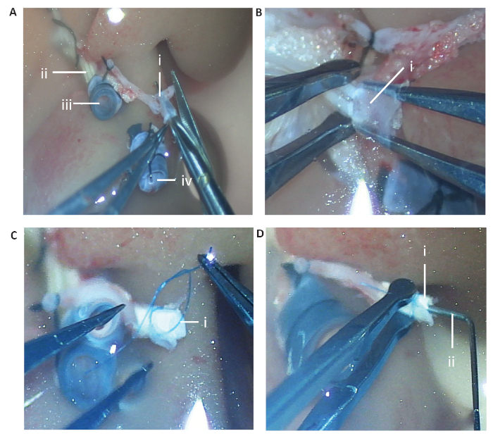 figure-results-2 Surgical technique steps for vascular anastomosis; close-up, labeled procedural images