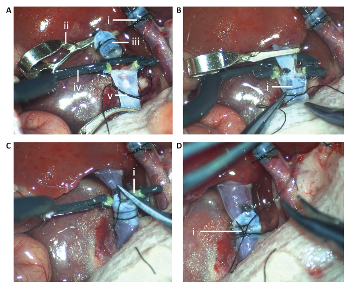 figure-results-3 Surgical procedure images showing vascular anastomosis with clamps and suturing techniques.