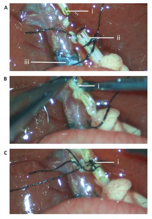 figure-results-5 Surgery procedure steps diagram with labeled suture techniques and anatomical structures.