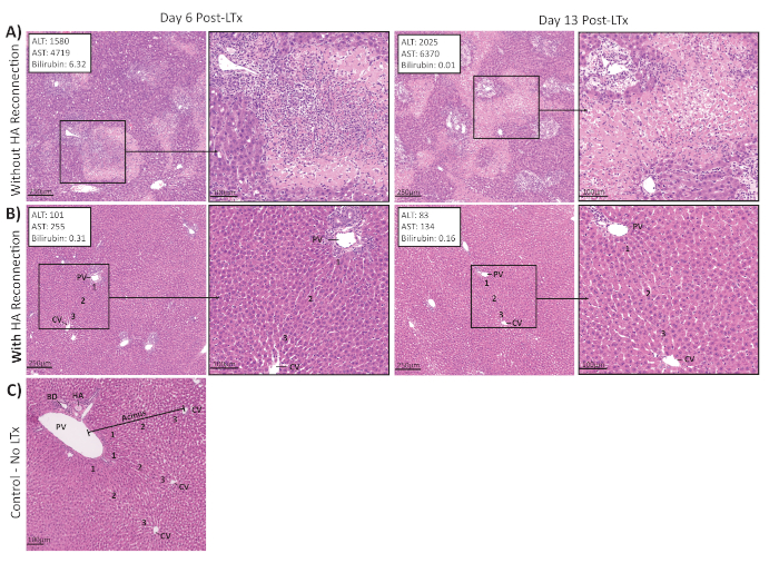 figure-results-7 Liver histology post-transplantation; microscopy images; HA reconnection vs. control; ALT, AST data.