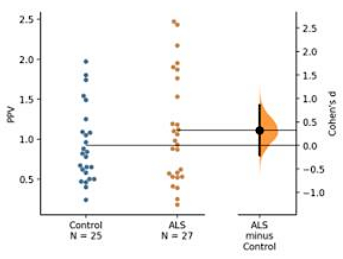 Scatter and violin plot comparing PPV in ALS vs. control groups, illustrating Cohen's d effect size.