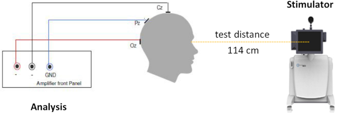 EEG setup for brain stimulation; diagram with amplifier connections and distance measurement.