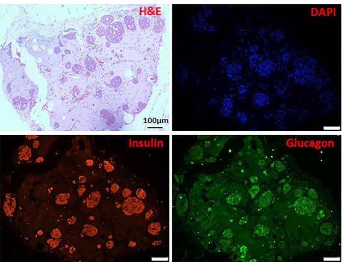 Inguinal Subcutaneous White Adipose Tissue (ISWAT) Transplantation ...