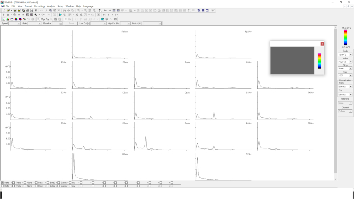 Spectroscopy analysis; graph showing spectral data, likely transient absorption spectroscopy results.