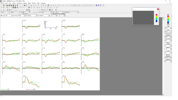 Transient absorption spectra, global analysis fitting, data graph in spectroscopy software interface.
