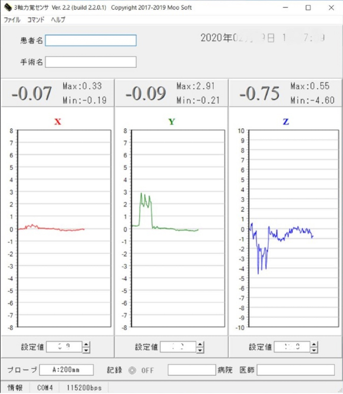 Triaxial force analysis graph; X, Y, Z data; max/min values; experimental data chart.