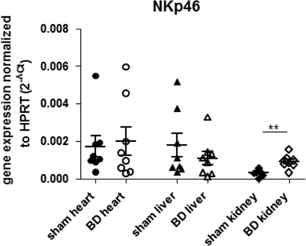 figure-results-2 NKp46 expression chart, gene expression normalized to HPRT, analyzed in various organs for experimental study.