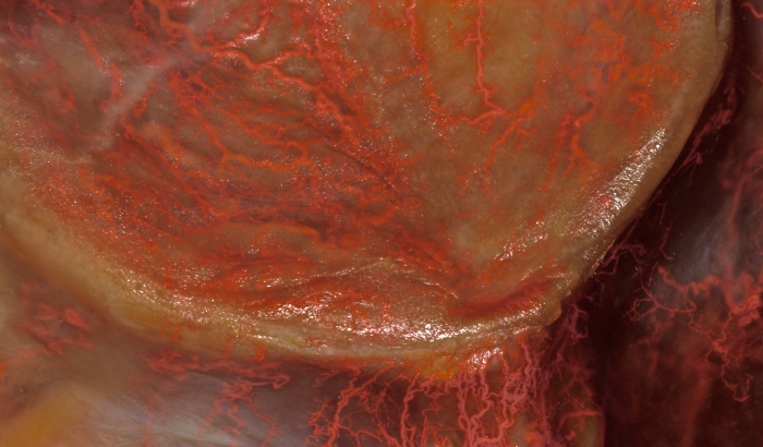 Human placenta close-up showing vascular network; anatomical diagram for biology education.
