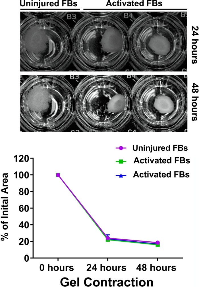 Gel contraction over 48 hours, showing uninjured and activated FBs in wells, with contraction graph.