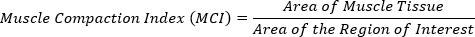 figure-protocol-1 Muscle Compaction Index formula; ratio of muscle tissue area to region of interest area, equation.