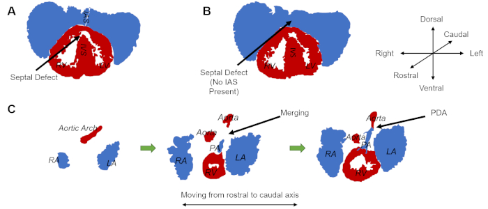 Diagrama de cardiopatia congênita; defeitos septais, conexões das câmaras cardíacas, estágios de desenvolvimento.