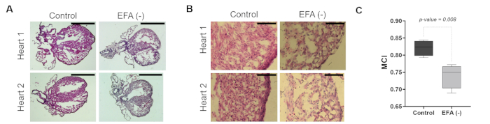 Comparação histológica cardíaca com controle vs. AFE(-); inclui imagens de microscopia e análise de gráfico de caixa MCI.