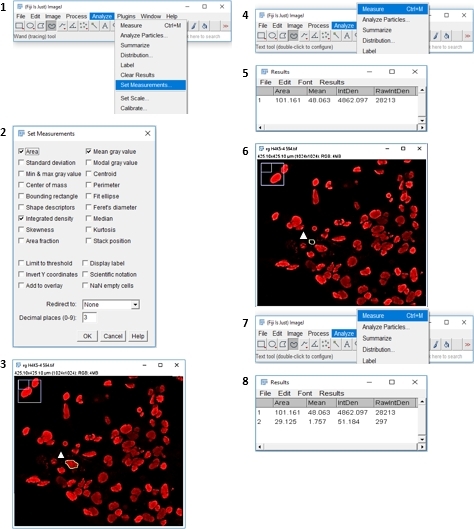 ImageJ analysis process; measurement settings and results for particle analysis in microscopy images.
