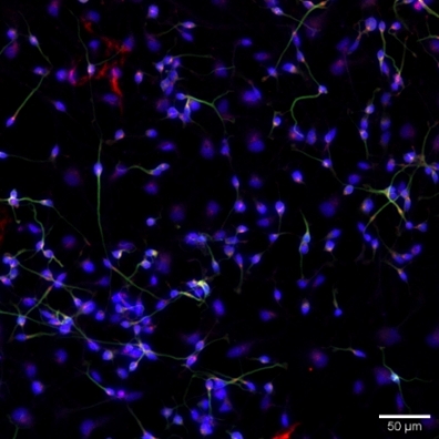 Fluorescence microscopy image of stained cells, showing cellular structures and protein localization.